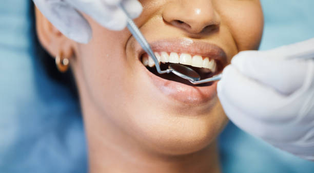 Best Urgent Dental Care in Moreauville, LA